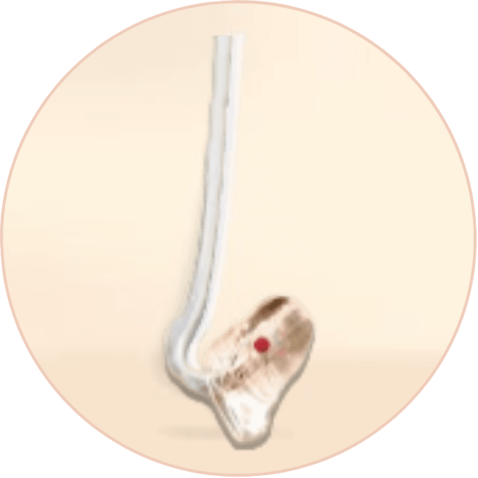 พิมพ์หู